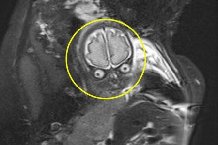 Фото - Родители испугались скана МРТ своего ребёнка, который находился в утробе