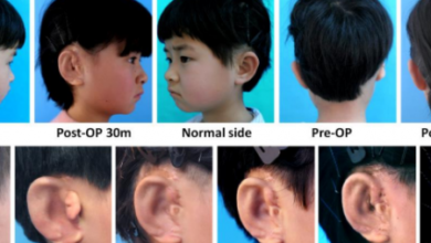 Фото - Учёные вырастили уши и пересадили их детям