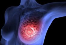 Фото - Аспирин при раке груди может помочь или убить
