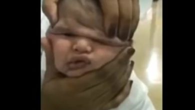Фото - Медсёстры реанимации издевались над больным младенцем