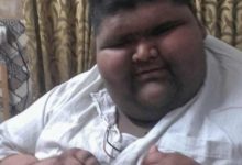 Фото - Самый толстый ребенок в мире похудел на 65 килограммов