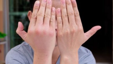 Фото - Отёки кистей и пальцев говорят о скрытых болезнях