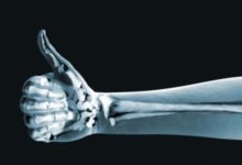 Фото - Терагерцевое излучение может заменить рентген в некоторых областях медицины