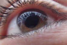 Фото - Возможно ли лечение катаракты без операции?