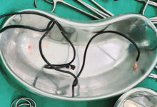 Фото - Хирург удивился, обнаружив в теле пациента неожиданный инородный предмет