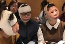 Фото - Китаянки не смогли улететь домой после выполненных в Южной Корее пластических операций