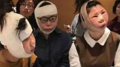 Фото - Китаянки не смогли улететь домой после выполненных в Южной Корее пластических операций