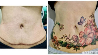 Фото - Молодая талантливая татуировщица помогает женщинам бороться со шрамами