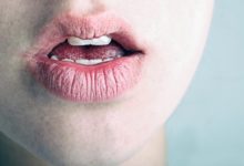 Фото - Сухие губы, трещинки, раздражение: почему они появляются и что делать