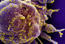 Фото - Учёные рассказали о влиянии коронавируса на образование опухоли мозга
