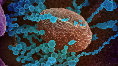 Фото - Объяснено развитие тяжелых осложнений от коронавируса