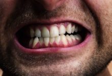 Фото - Почему зубы — это не кости?