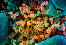 Фото - Подтвержден долгий иммунитет при тяжелой инфекции коронавируса