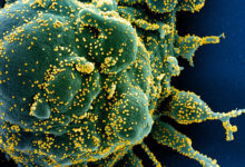 Фото - Раскрыта картина поражения легких при коронавирусе