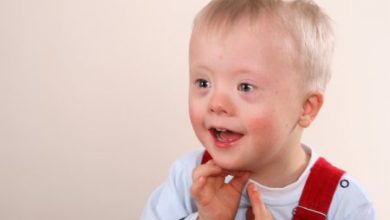 Фото - Ученые: черты лица у детей с синдромом Дауна можно изменить без операции