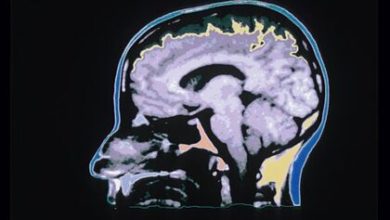 Фото - Ученые обнаружили указывающие на признаки рака «горячие точки» в мозгу