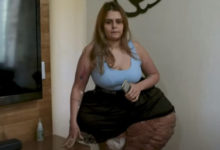 Фото - Женщина надеется собрать деньги, чтобы уменьшить гигантскую опухоль на ноге