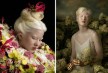 Фото - Девочка, от которой отказались из-за альбинизма, стала моделью