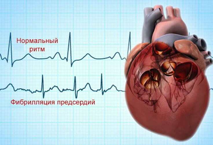 Рыбий жир может быть опасен: в чем вред биодобавки