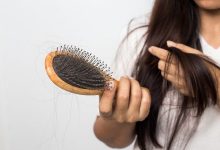 Фото - Какой ингредиент шампуня вызывает выпадение волос, зуд и перхоть: врач