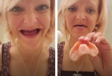 Фото - Мать семейства потеряла зубы и призывает людей не стесняться зубных протезов