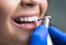 Фото - Какие бывают зубные щётки и почему их недостаточно для правильной чистки