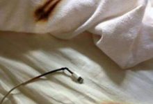 Фото - Врачи рассказали и показали, как опасно заряжать телефоны в кровати