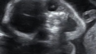 Фото - Беременная женщина испугалась, посмотрев на УЗИ-снимок своего ребёнка