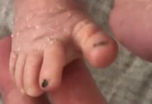 Фото - Мама, которая не может различать дочек-близняшек, красит одной из них ногти