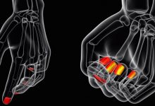Фото - Из чего состоят ногти человека и что они могут рассказать о здоровье?