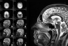 Фото - Может ли сканирование мозга объяснить поведение человека?