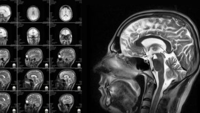 Фото - Может ли сканирование мозга объяснить поведение человека?