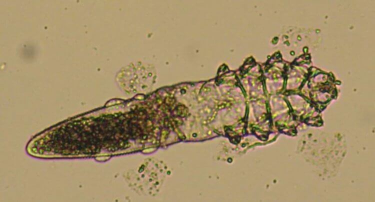 На лице человека живут крошечные клещи. Что о них известно?