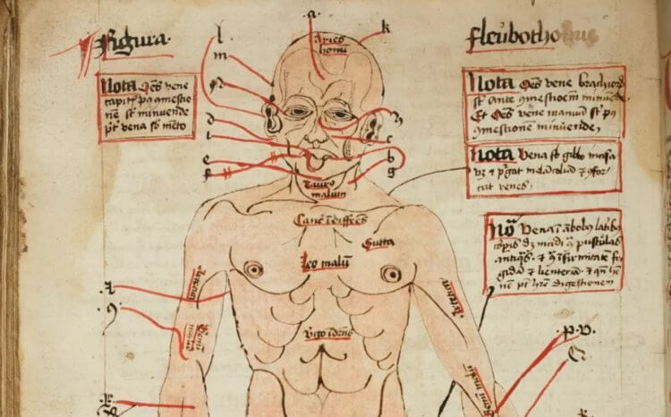 Фаршированный щенок и соленые птицы: как средневековые врачи лечили больных людей