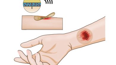 Фото - Ученые создали смарт-пластырь, который заживляет раны с помощью ударов тока