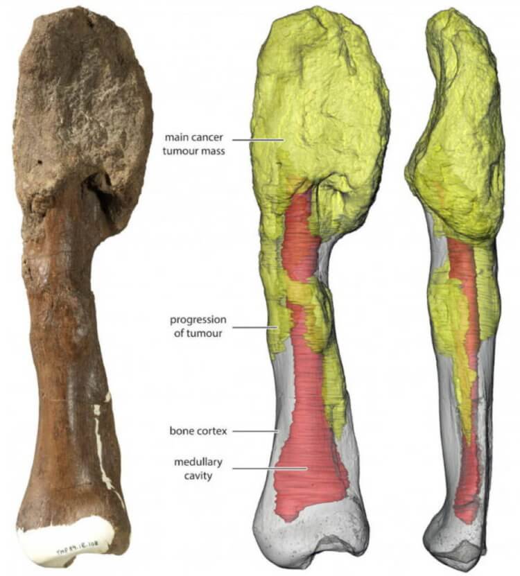 Найдены первые останки динозавра, умершего от рака
